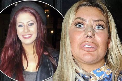 chloe geordie shore before after|photos of chloe ferry.